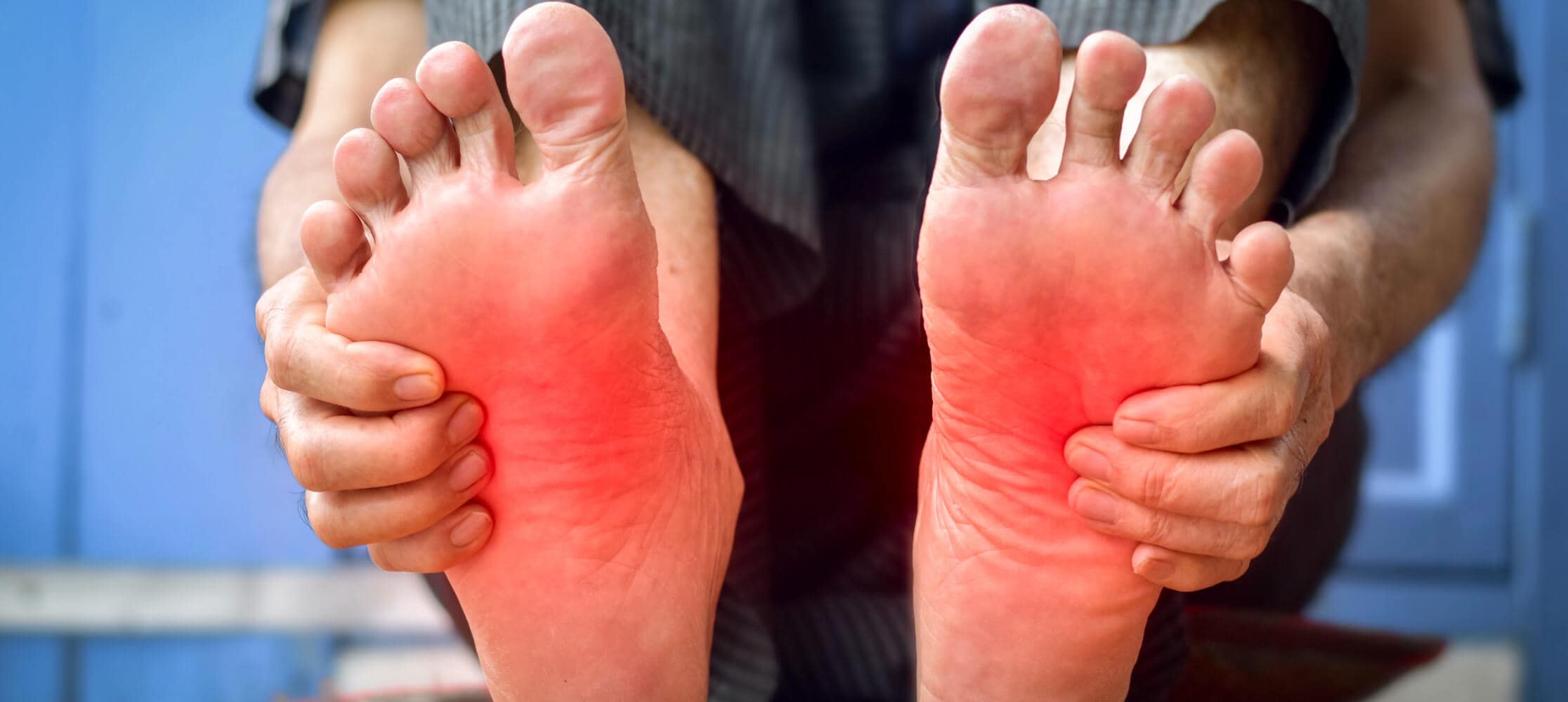 burned feet